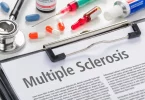 Recent Medical Breakthroughs in Multiple Sclerosis Care