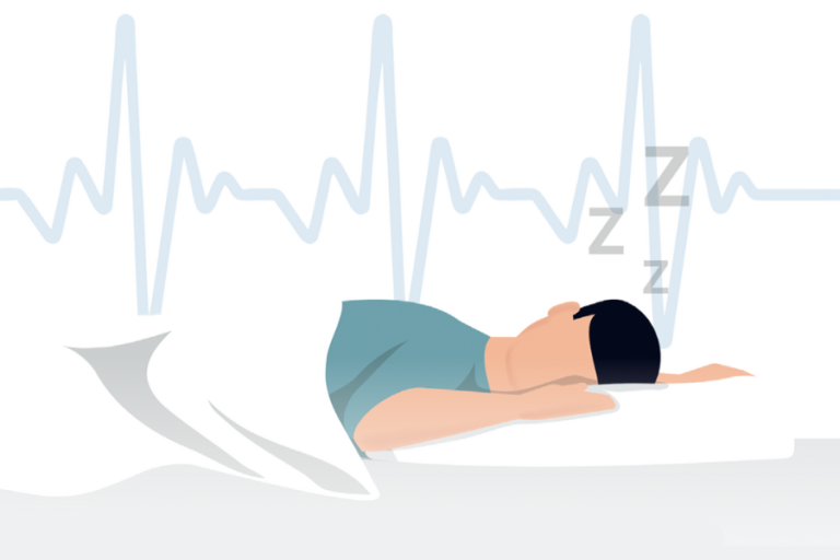 Sleep Health