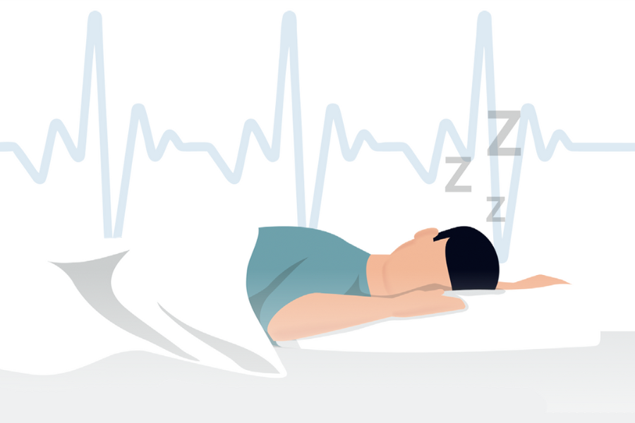 Sleep Health